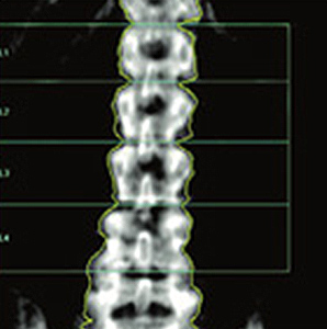 densitometria3