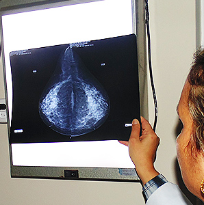 mamografia3
